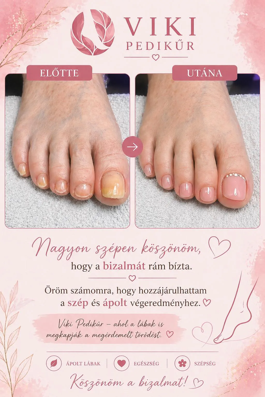 Referencia munka 29 — Viki Pedikűr Kalocsa